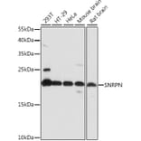 Western Blot - Anti-SNRPN Antibody (A88678) - Antibodies.com