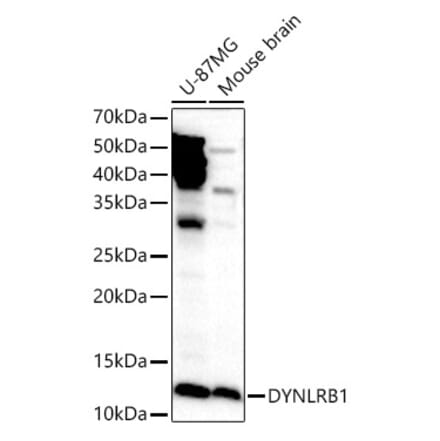 Western Blot - Anti-DYNLRB1 Antibody (A88679) - Antibodies.com