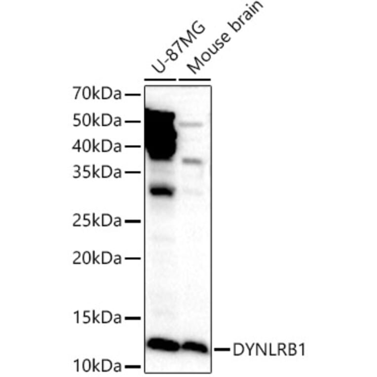 Western Blot - Anti-DYNLRB1 Antibody (A88679) - Antibodies.com