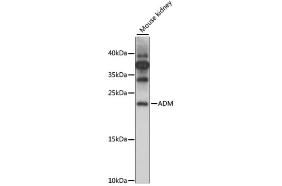 Western Blot - Anti-Adrenomedullin/ADM Antibody (A88680) - Antibodies.com