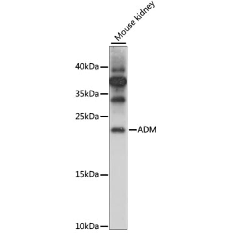 Western Blot - Anti-Adrenomedullin/ADM Antibody (A88680) - Antibodies.com