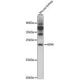 Western Blot - Anti-Adrenomedullin/ADM Antibody (A88680) - Antibodies.com