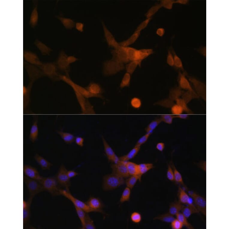 Immunofluorescence - Anti-PUMA Antibody (A88681) - Antibodies.com