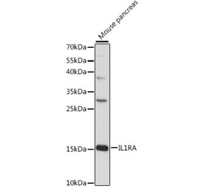 Western Blot - Anti-IL-1RA Antibody (A88682) - Antibodies.com