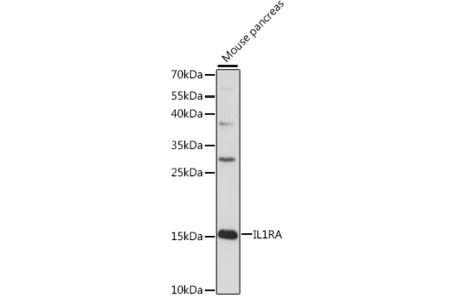 Western Blot - Anti-IL-1RA Antibody (A88682) - Antibodies.com