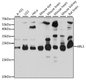 Western Blot - Anti-ARL3 Antibody (A88683) - Antibodies.com