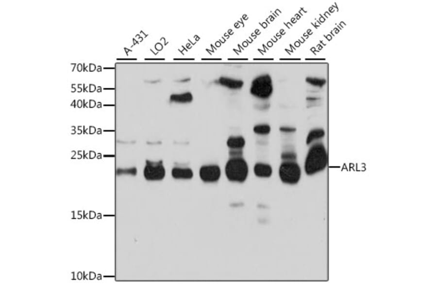 Western Blot - Anti-ARL3 Antibody (A88683) - Antibodies.com