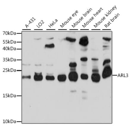 Western Blot - Anti-ARL3 Antibody (A88683) - Antibodies.com