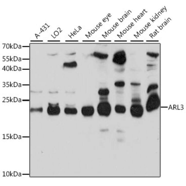 Western Blot - Anti-ARL3 Antibody (A88683) - Antibodies.com