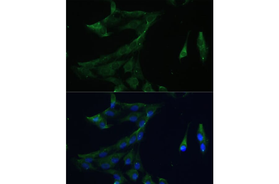 Immunofluorescence - Anti-ARL3 Antibody (A88683) - Antibodies.com