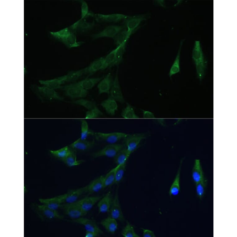 Immunofluorescence - Anti-ARL3 Antibody (A88683) - Antibodies.com