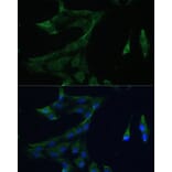 Immunofluorescence - Anti-ARL3 Antibody (A88683) - Antibodies.com