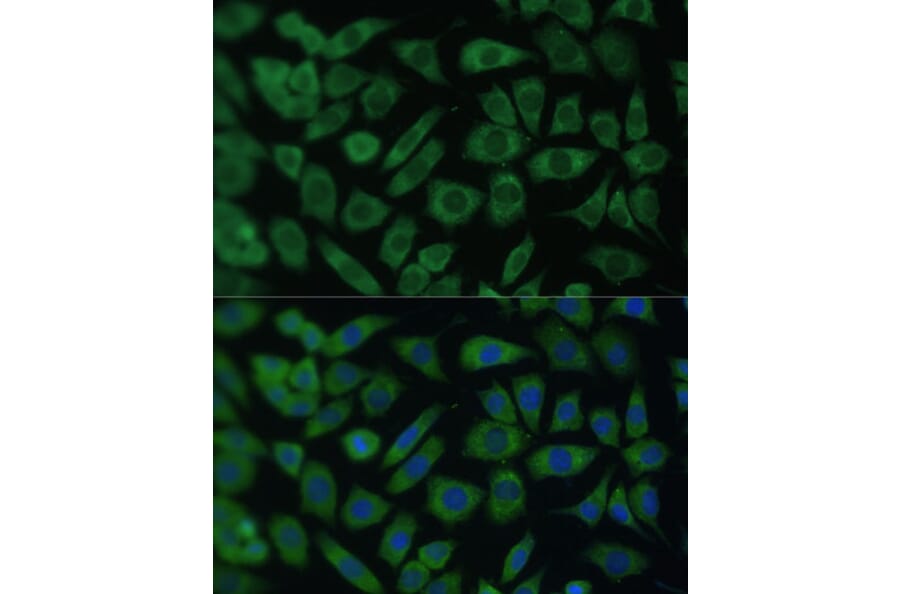 Immunofluorescence - Anti-ARL3 Antibody (A88683) - Antibodies.com