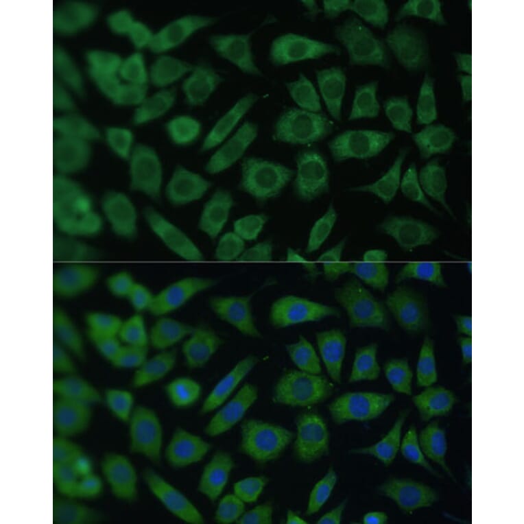 Immunofluorescence - Anti-ARL3 Antibody (A88683) - Antibodies.com