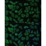 Immunofluorescence - Anti-ARL3 Antibody (A88683) - Antibodies.com