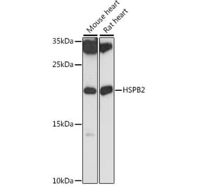 Western Blot - Anti-Hsp27 Antibody (A88684) - Antibodies.com