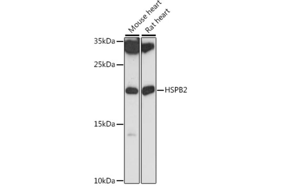 Western Blot - Anti-Hsp27 Antibody (A88684) - Antibodies.com