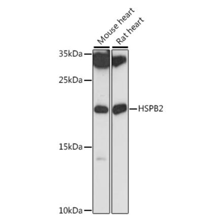 Western Blot - Anti-Hsp27 Antibody (A88684) - Antibodies.com