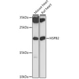 Western Blot - Anti-Hsp27 Antibody (A88684) - Antibodies.com
