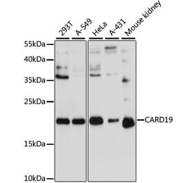 Western Blot - Anti-BinCARD Antibody (A88685) - Antibodies.com