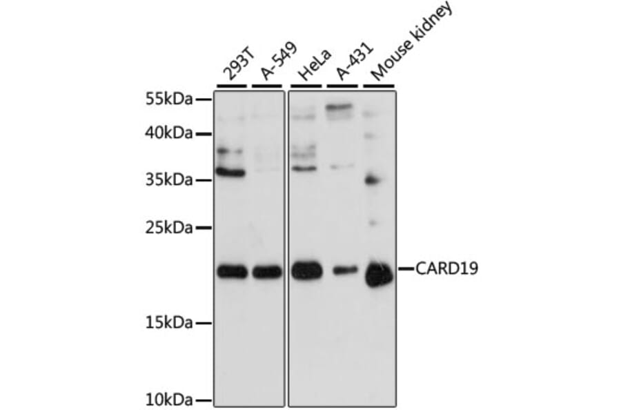 Western Blot - Anti-BinCARD Antibody (A88685) - Antibodies.com