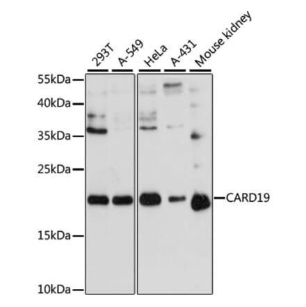 Western Blot - Anti-BinCARD Antibody (A88685) - Antibodies.com