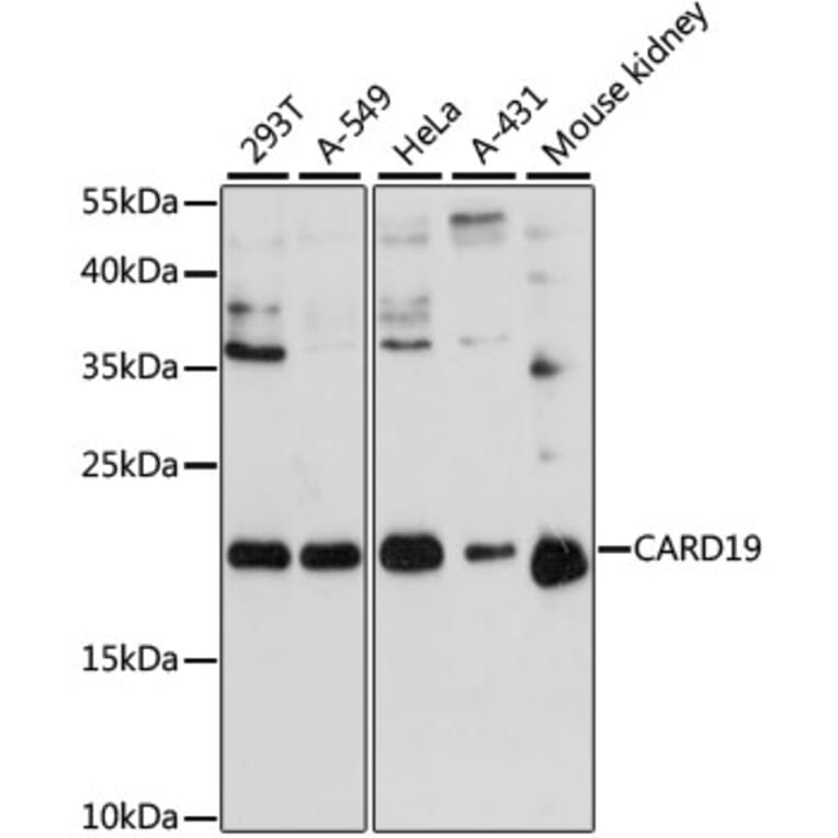 Western Blot - Anti-BinCARD Antibody (A88685) - Antibodies.com
