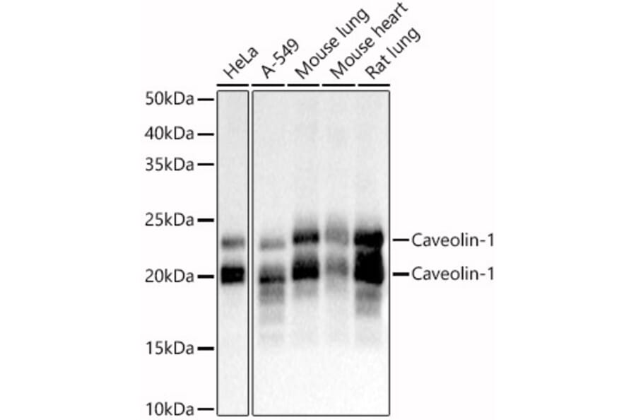 Western Blot - Anti-Caveolin 1 Antibody (A88686) - Antibodies.com