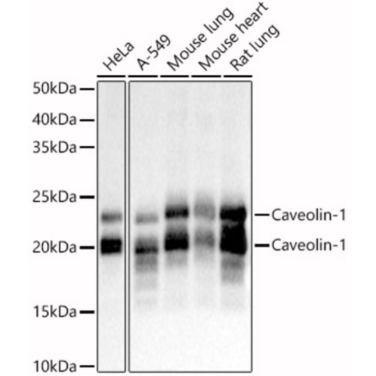 Western Blot - Anti-Caveolin 1 Antibody (A88686) - Antibodies.com