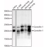 Western Blot - Anti-Caveolin 1 Antibody (A88686) - Antibodies.com