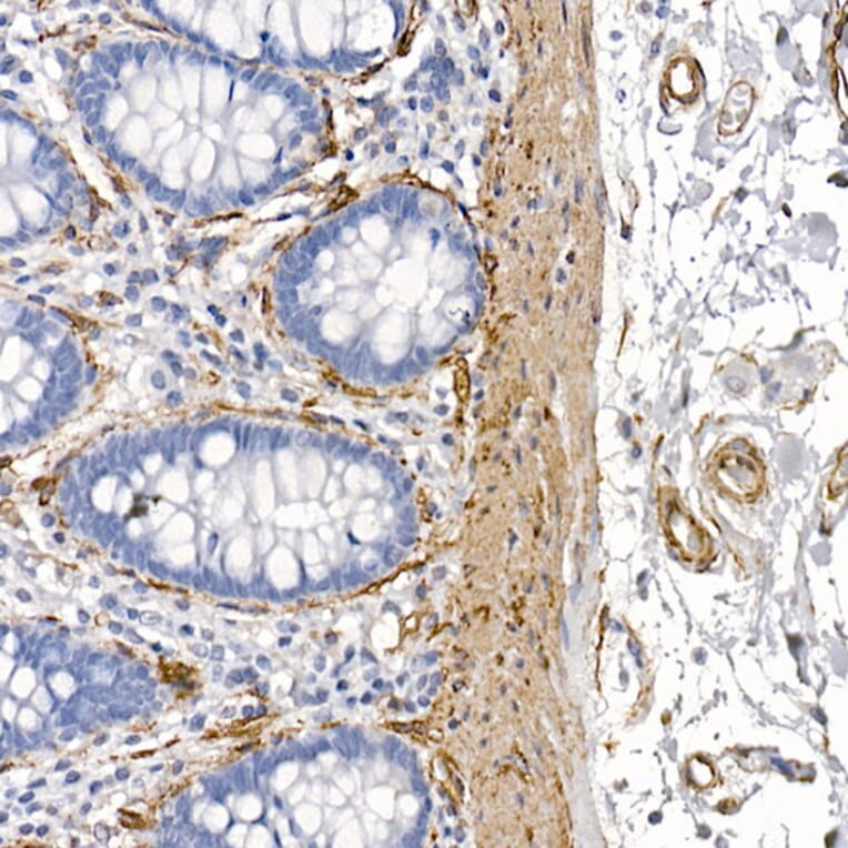 Immunohistochemistry - Anti-Caveolin 1 Antibody (A88686) - Antibodies.com