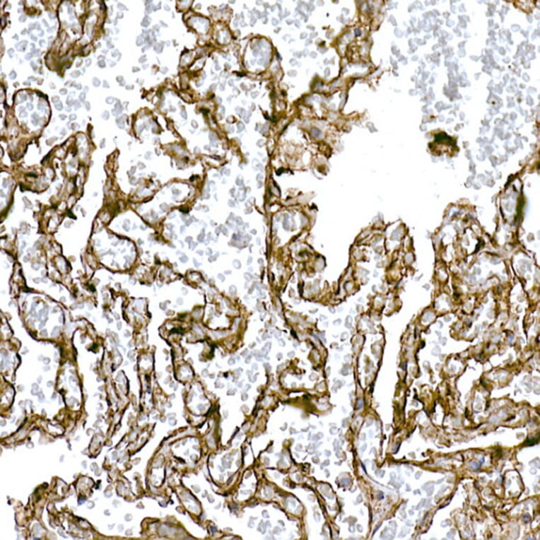 Immunohistochemistry - Anti-Caveolin 1 Antibody (A88686) - Antibodies.com