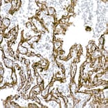 Immunohistochemistry - Anti-Caveolin 1 Antibody (A88686) - Antibodies.com