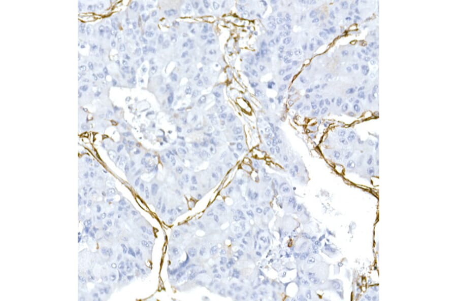 Immunohistochemistry - Anti-Caveolin 1 Antibody (A88686) - Antibodies.com