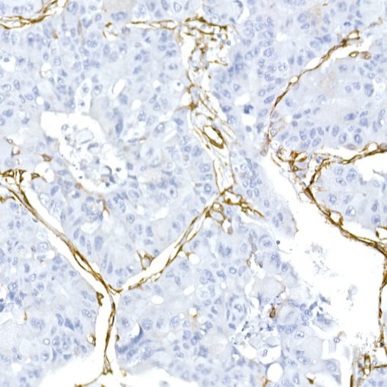 Immunohistochemistry - Anti-Caveolin 1 Antibody (A88686) - Antibodies.com