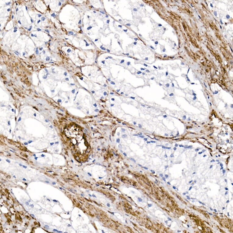 Immunohistochemistry - Anti-Caveolin 1 Antibody (A88686) - Antibodies.com