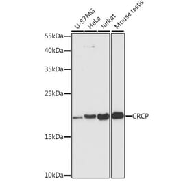 Western Blot - Anti-CRCP Antibody (A88687) - Antibodies.com