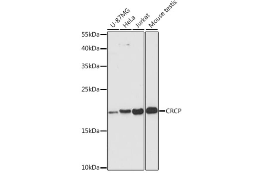 Western Blot - Anti-CRCP Antibody (A88687) - Antibodies.com