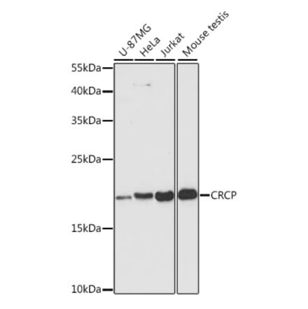 Western Blot - Anti-CRCP Antibody (A88687) - Antibodies.com