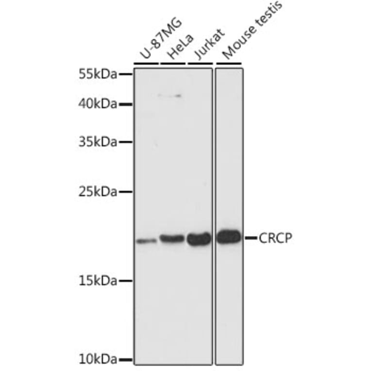 Western Blot - Anti-CRCP Antibody (A88687) - Antibodies.com