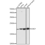 Western Blot - Anti-CRCP Antibody (A88687) - Antibodies.com