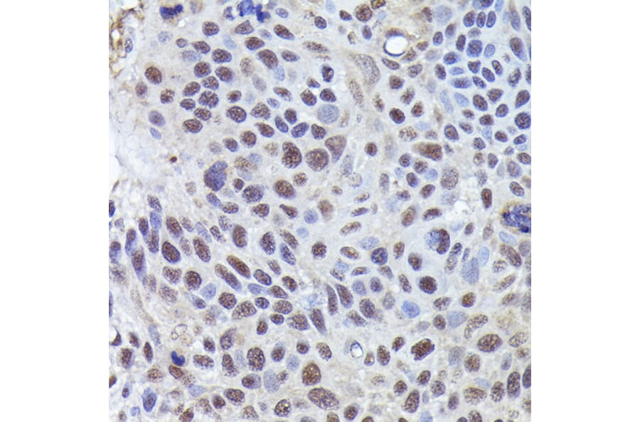 Immunohistochemistry - Anti-CRCP Antibody (A88687) - Antibodies.com