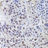 Immunohistochemistry - Anti-CRCP Antibody (A88687) - Antibodies.com