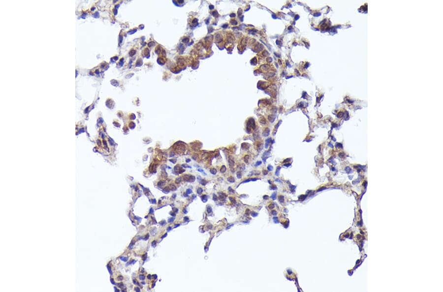 Immunohistochemistry - Anti-CRCP Antibody (A88687) - Antibodies.com
