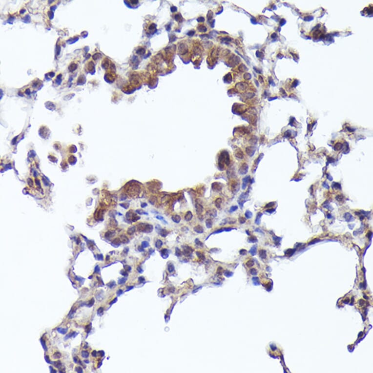 Immunohistochemistry - Anti-CRCP Antibody (A88687) - Antibodies.com