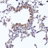 Immunohistochemistry - Anti-CRCP Antibody (A88687) - Antibodies.com