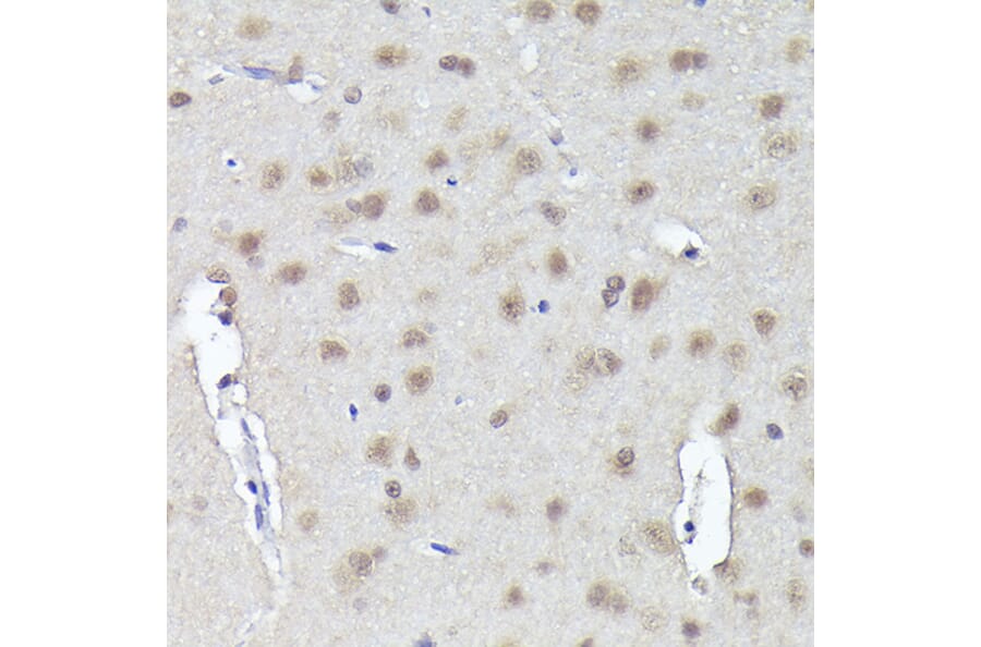 Immunohistochemistry - Anti-CRCP Antibody (A88687) - Antibodies.com
