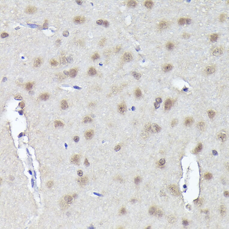 Immunohistochemistry - Anti-CRCP Antibody (A88687) - Antibodies.com