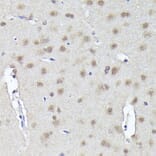 Immunohistochemistry - Anti-CRCP Antibody (A88687) - Antibodies.com