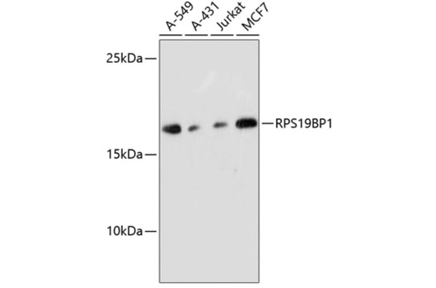 Western Blot - Anti-RPS19BP1/AROS Antibody (A88688) - Antibodies.com